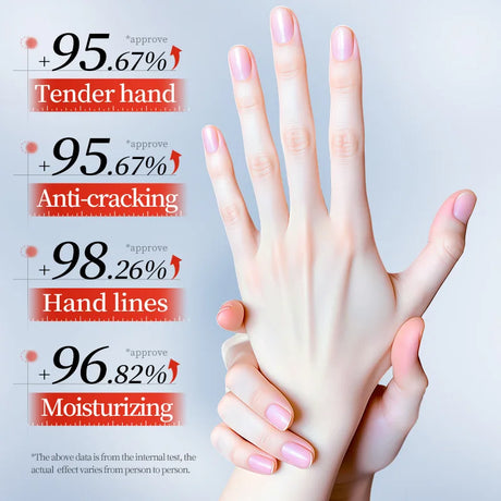 SADOER Urea Anti-Cracking Hand Cream Deep Moisturizing Improve Dryness Relieve Itching Panthenol HA Nourish Hand Skin Care