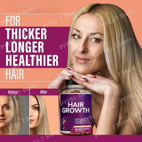 Biotin Collagen Hair Growth Supplement with Vitamins A C D3 E B12 Zinc Supports hair wellness appearance for Women