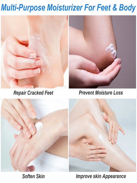 Urea Cream 42% Plus Salicylic Acid 2%, Lavender Foot Cream for Dry Cracked Heels Treatment Knees Elbows Hands Repair Treatment,