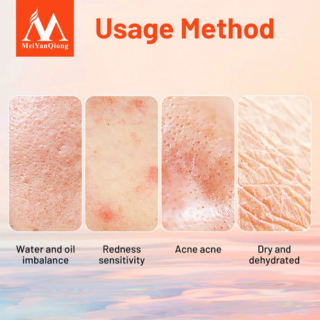 Repair Aloe Vera Gel Moisturizing Skin Care Natural Plant Extracts Ance Treatment Mild Soothing Face Care Day Cream Nourish 100G
