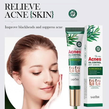 SADOER Tea Tree Acne Removing Cream Facial skincare Oil Control Face Gel Creams Hydrating Moisturizing Facial Cream Skin Care