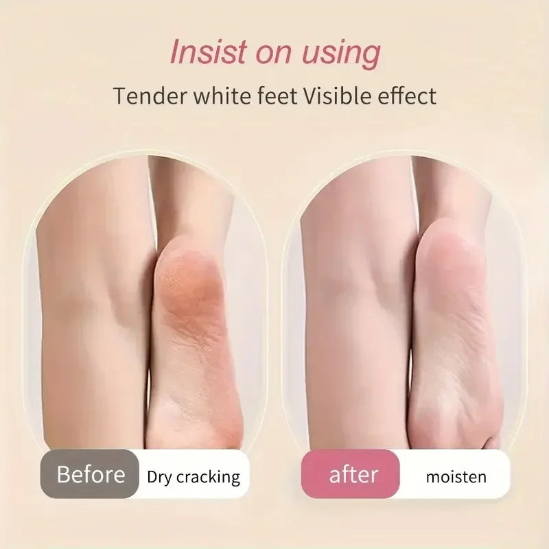 2 Pieces Silicone Foot Care Socks, Moisturizing Protection, Softening Dry, Cracked Heels, Foot Care Tools for Men and Women
