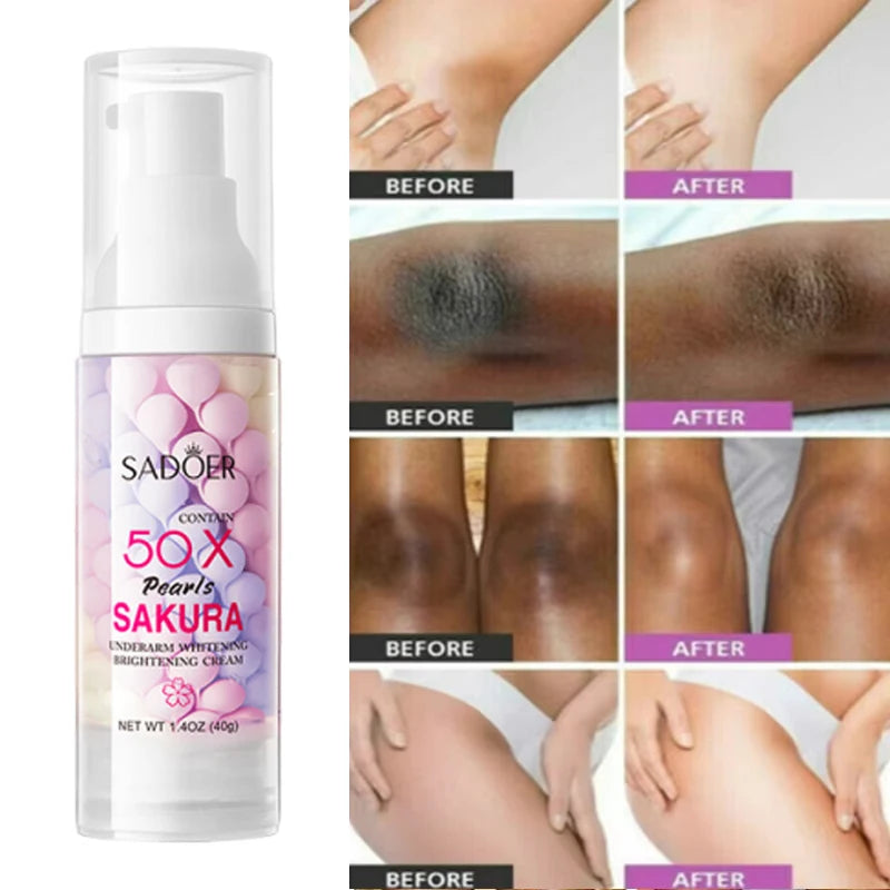 Whitening Cream Private Parts Underarm Bleaching Serum Whiten Butt Knee Brighten Inner Thigh Intimate Parts Dark Remove Melanin