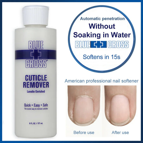 30/177/473Ml Nail Cuticle Removal Gel Cream Foot Cuticle Remove Soften Dead Skin Foot Exfoliation Softener
