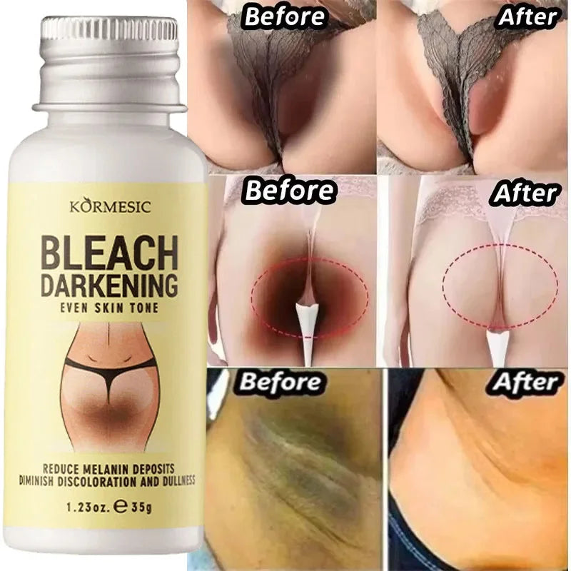 Body Whitening Cream Private Parts Underarm Bleaching Serum Whiten Butt Knee Brighten Inner Thigh Intimate Dark Remove Melanin