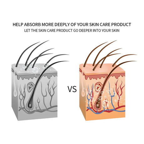 5 In 1 Home Facial Beauty Device Mesotherapy Electroporation RF Radio Frequency Facial LED Photon Skin Care Beauty Device Face Lifting Tighten