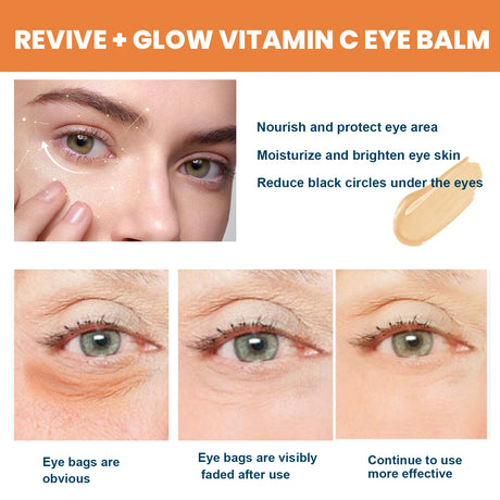 Vitamin C Eye Cream Nourishing Remove Dark Circles Fade Fine Lines Enhance Skin Elasticity Glowing Eye Skin Cream
