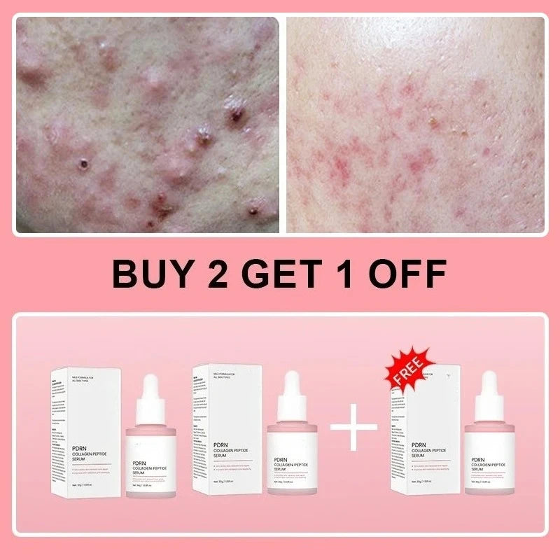 Collagen Peptide Facial Serum Targets Dull Skin Boosts Skin Elasticity Stimulates Skin Renewal Repair Salmon PDRN KOREAN Product
