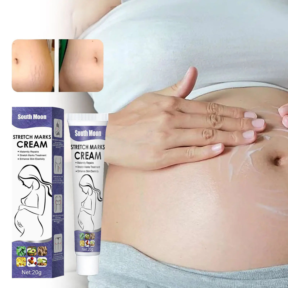 Stretch Marks Permanent Removal Cream Maternity Pregnant Women Pregnancy Anti-Winkle Smooth Repair Firming Skin Body Skin Care