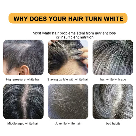 Jaysuing Hair Soap For Scalp Cleansing,Repair Damaged Hair Improve Hair Toughness and Promote Hair Growth Hair Shampoo Soap