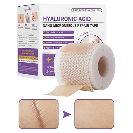 Surgical Soft Silicone Gel Scar Sheet Patch Treatmen Removal Tape Acne Trauma Burn Scar Cover Skin Repair Section Ear Beauty