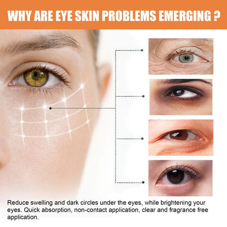 Vitamin C Eye Cream Nourishing Remove Dark Circles Fade Fine Lines Enhance Skin Elasticity Glowing Eye Skin Cream