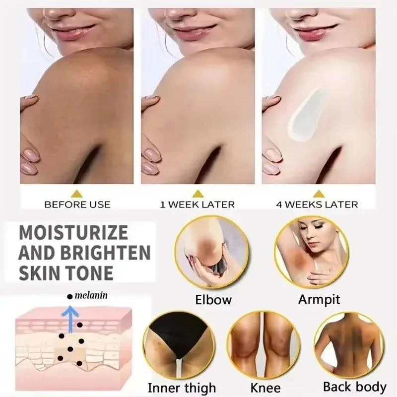 Body Whitening Cream Private Parts Underarm Bleaching Serum Whiten Butt Knee Brighten Inner Thigh Intimate Dark Remove Melanin