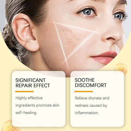 Bee Venom Skin Treatment Cream Skin Blemish Remover Moisturizing Skin Elasticity Increased Smooth Body Care Bee Venom Cream 60g