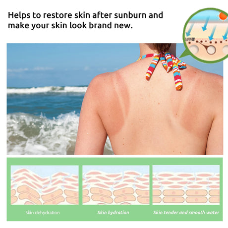 Aloe Vera After Sun Repair Cream,Triple Threat Damage Control,Instant Cooling&Redness Banisher,Cell Plumping&Rehydration,Anti Sun Spot&Brightening Power,Flawless Tan Extender,Collagen Recovery Booster,Ultra Lightweight Hydro