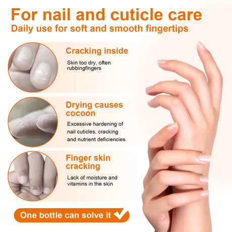 TWOING Honey Milk Cuticle Oil - 30ml Dropper Nail & Cuticle Moisturizer for Dry Skin And Thin Nails Nail Nutrition Oil