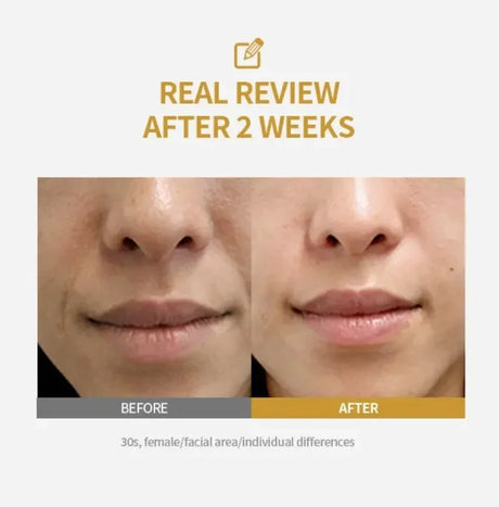 Deep Collagen Essence Peptide Activation Pink PDRN Stem Cell Ampoule Brightening Moisturizing Skincare