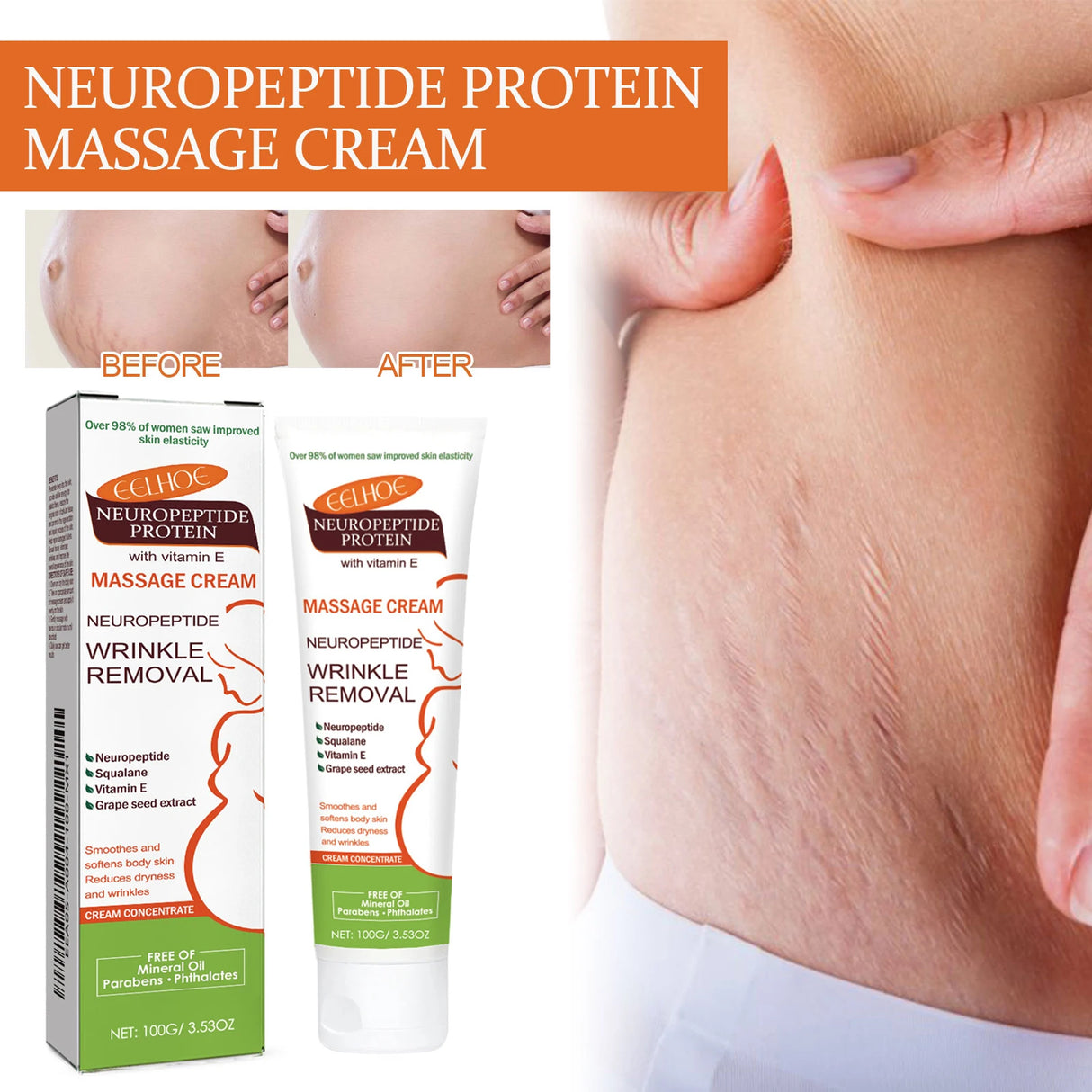 100g Stretch Marks Permanent Removal Cream Maternity Pregnant Women Pregnancy Anti-Winkle Smooth Repair Firming Skin Body Care