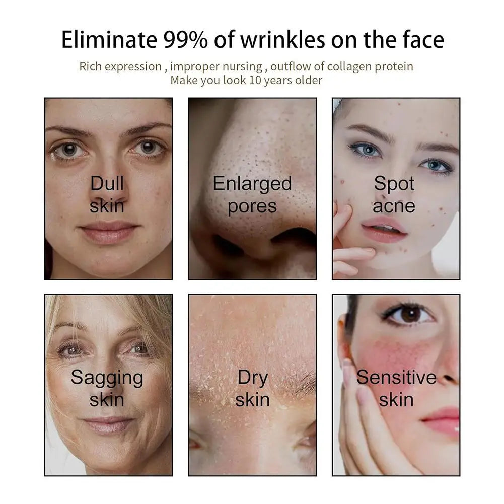 Rosehip Oil Black Seed Oil And Castor Oil Face Serum Natural Castor Oil Black Seed Oil Face Essence Collagen Facial Moisturizer