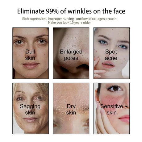 Rosehip Oil Black Seed Oil And Castor Oil Face Serum Natural Castor Oil Black Seed Oil Face Essence Collagen Facial Moisturizer