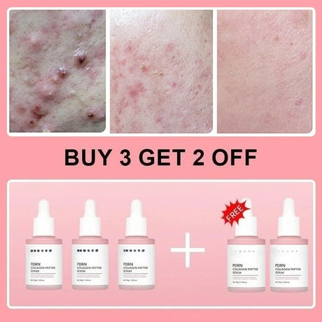 Collagen Peptide Facial Serum Targets Dull Skin Boosts Skin Elasticity Stimulates Skin Renewal Repair Salmon PDRN KOREAN Product