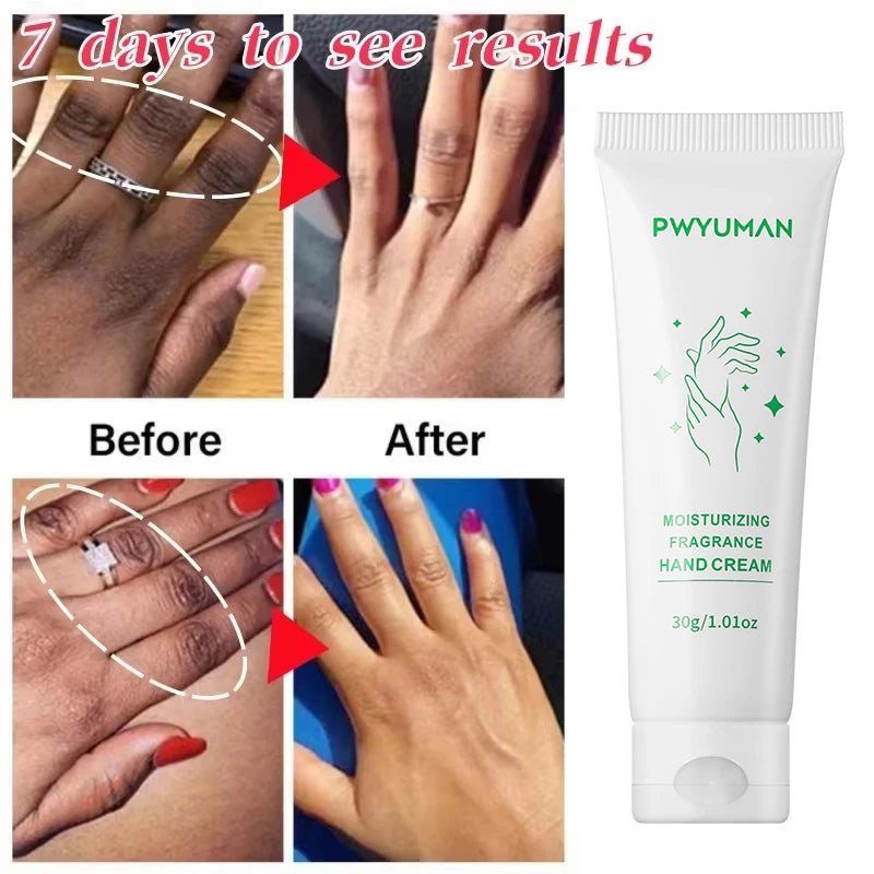 Whitening Cream Private Parts Underarm Bleaching Serum Whiten Butt Knee Brighten Inner Thigh Intimate Parts Dark Remove Melanin