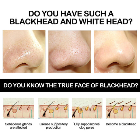 Bamboo Charcoal Blackhead Remover Mask Deep Cleanig Purifying Shrink Pores Cream Oil Control Exfoliator Peel Mud Mask Skin Care