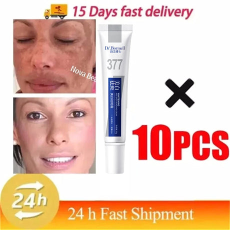 Powerful Spot-Removing Whiten Cream Brighten Skin Fast Eliminates Melanin Pigmentation Melasma Dark Spots Korean Face Skin Care