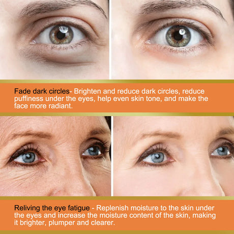 Vitamin C Eye Cream Nourishing Remove Dark Circles Fade Fine Lines Enhance Skin Elasticity Glowing Eye Skin Cream