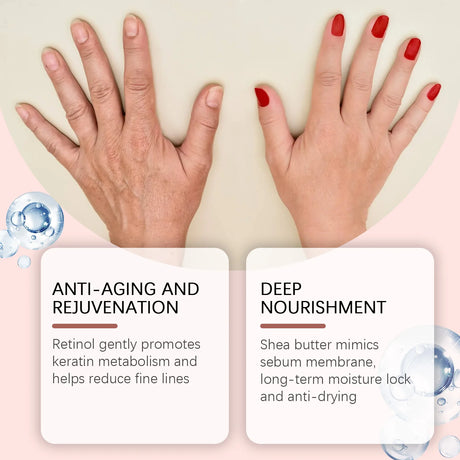 Retinol Hand Cream Firming Hand Lotion Retinol Moisturizer For Aging Dry Cracked Hands Hydrates & Soothes Dry Hands Non-Greasy