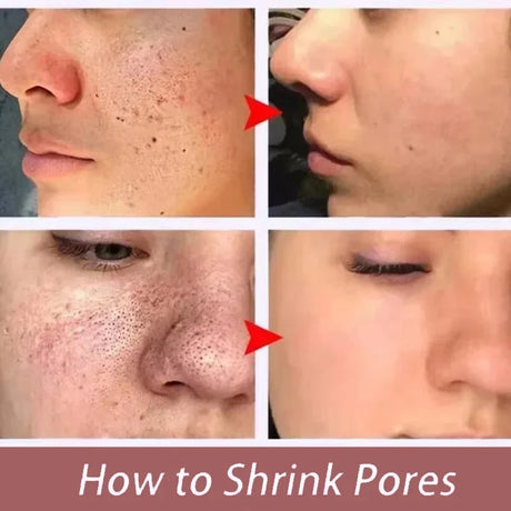 Feels Like Silk, Looks Like Filter. Salicylic Acid Pore Serum – Tightens, Minimizes, Firms, Smooths Enlarged Pores – Korean