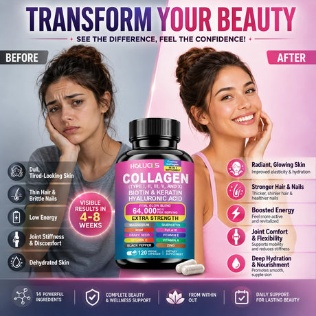 High Strength Collagen Complex, with Biotin, Hyaluronic Acid, Antioxidant, for Firm Skin, Strong Joints, Bone, Hair and Nails