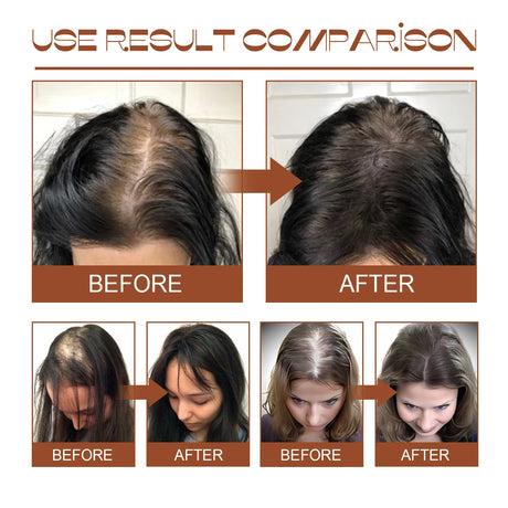 100% Pure Organic Hair Mask Batana Oil Hair Growth Oil Natural Treatment Nourish Reduce Hair Loss Anti-Breakage
