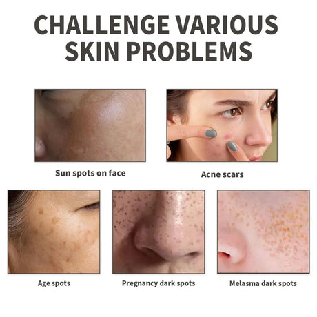 Vitamin B5 Face Serum Smooth Moisturizing Repair Dry Skin Aloe Soothe Pores Shrink Firming Hydrating Oil Control Facial Essence