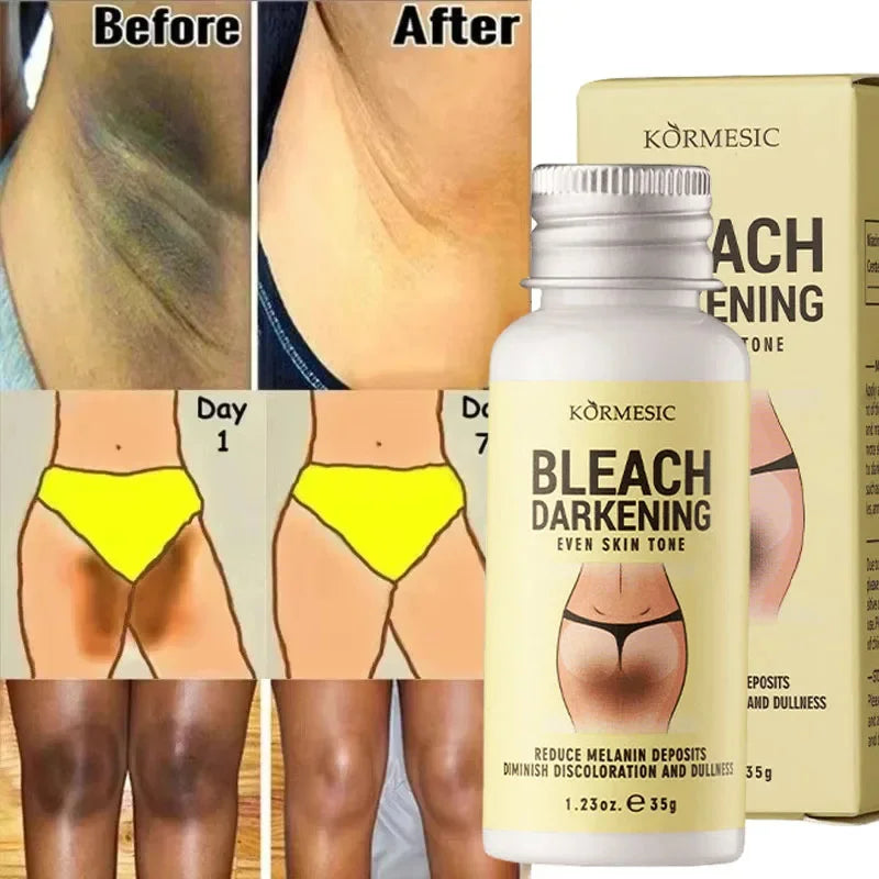 Body Whitening Cream Private Parts Underarm Bleaching Serum Whiten Butt Knee Brighten Inner Thigh Intimate Dark Remove Melanin