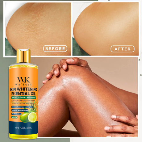 WK JALY Niacinamide Lightening Body Oil For All Skin, With Tea Tree, Lemon, Remove Acne, Fine Lines, Age Spot, Not Greasy, 300ml