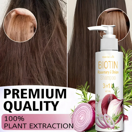 Daily Use Biotin Onion Rosemary Shampoo Gentle Mild Formula Clean Scalp Impurities Support Long Term Healthy Hair Growth 150g