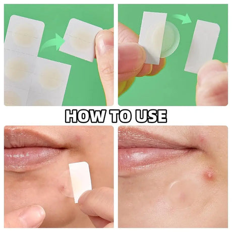 24PCS Microneedle AcnePatch Painlessly Penetrate Acne Patches Blemishes Pimples Covering Patch Daily Unisex Skincare