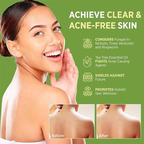 Tea Tree Oil Soap Bar for Men Women Natural Plant Extract Handmade Soap Deep Cleansing Soothing for Dry Skin Exfoliate Skin Care