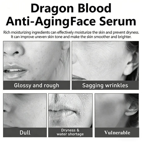 JUINHOU Dragon Blood Hydration Serum Infused With Dragon's Blood Extract Niacinamide Brighten Skin Refines Pores Bouncy All Day