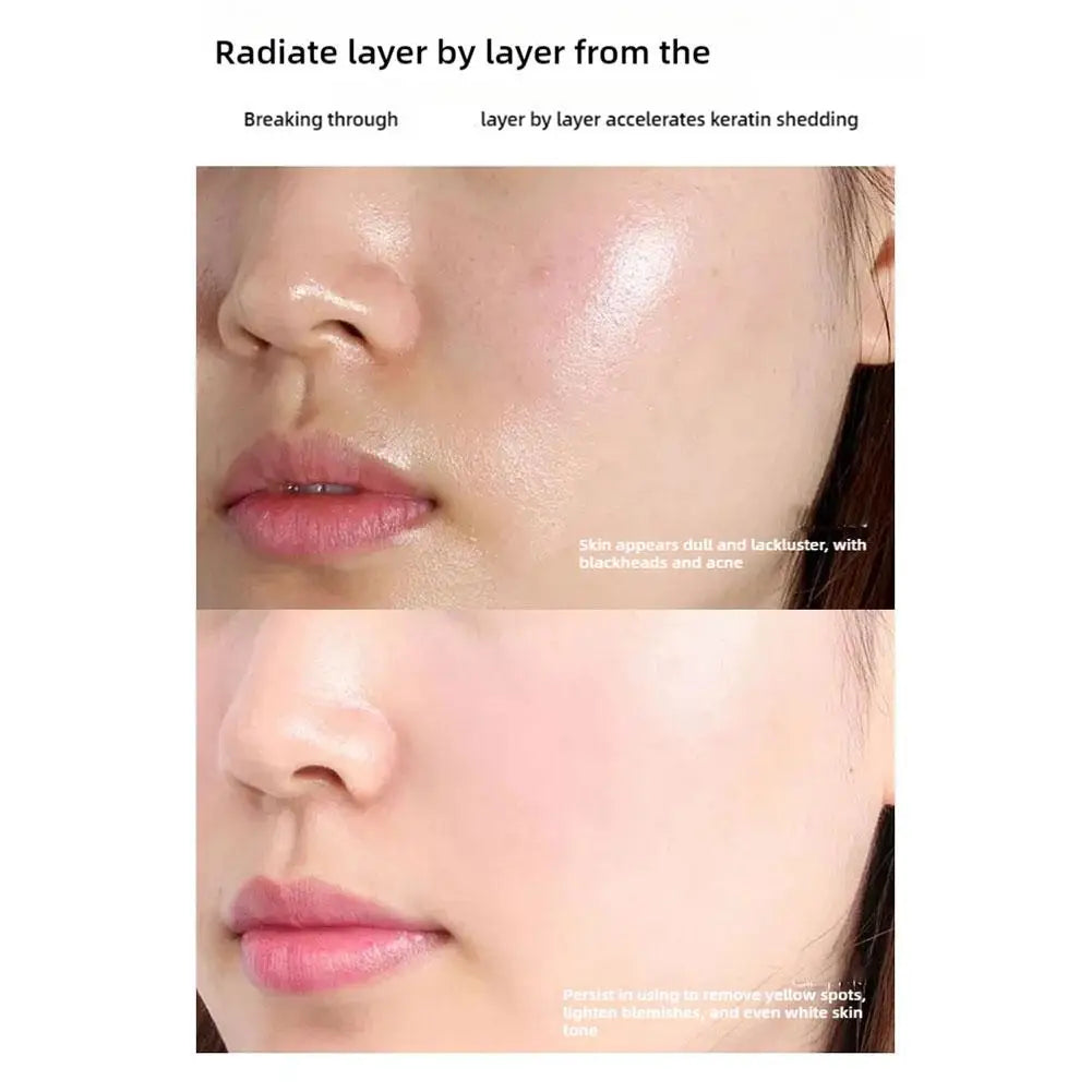 2/3PCS Spots Peel-Off Facial Mask Anti-Blemish Freckle Brightening Off Mask Deeply Clean Pore Tightening Moisturize Glowing Skin