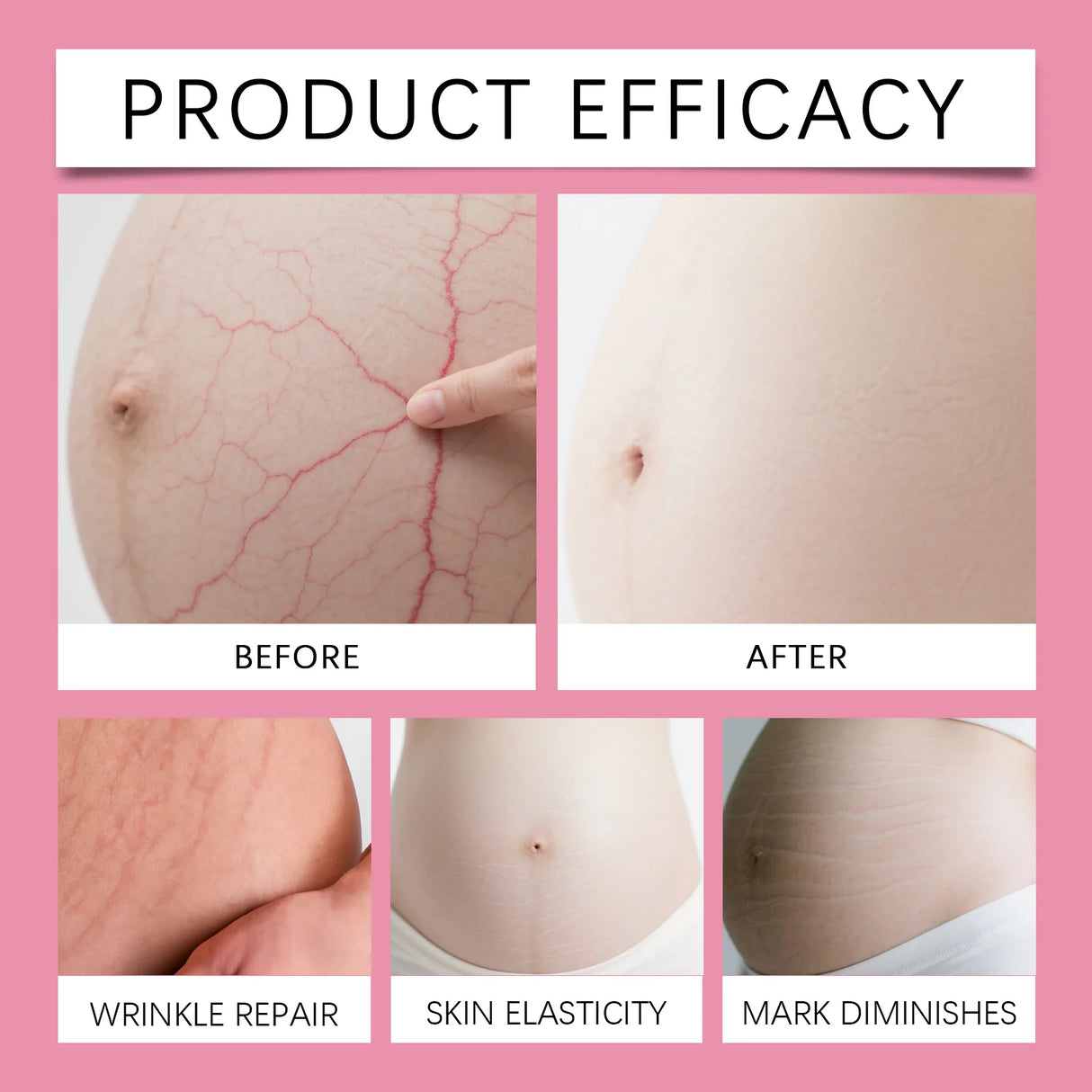 Pregnancy Belly Stretch Mark Cream for Elasticity Caffeine & Arnica Body Moisturizer Soothing Itchy Dry Skin Care for Moms to Be