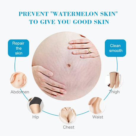 Snail Removes Stretch Mark Cream To Remove Postpartum Obesity Pregnant Women Repair Anti-Aging Anti-Winkles Firming Body Cream
