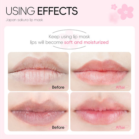LAIKOU 5/10pcs Lip Mask Lip Care Moisturizing Hydrating Repair Lighten Lip Lines Gel Patch Lips Pad Patches Care Products