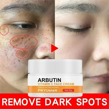 Dark Spots Remover Whitening Face Set Freckle Melanin Correcting Reduce Fine Lines Brighten Essence Korean Beauty Skin Care 