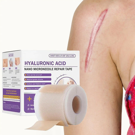 Surgical Soft Silicone Gel Scar Sheet Patch Treatmen Removal Tape Acne Trauma Burn Scar Cover Skin Repair Section Ear Beauty