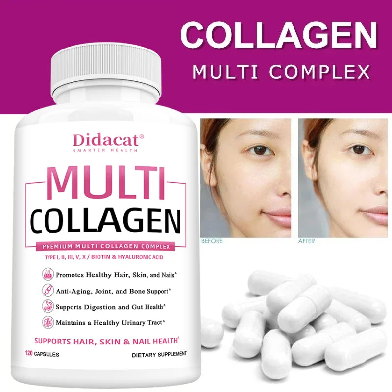Multi Collagen Capsules Type I II III V X, Anti-Aging Supports Radiant Skin, Strong Hair Nails, Joint Cartilage & Bone Health