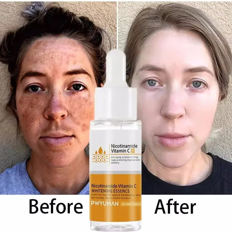 Dark Spots Remover Whitening Face Set Freckle Melanin Correcting Reduce Fine Lines Brighten Essence Korean Beauty Skin Care 