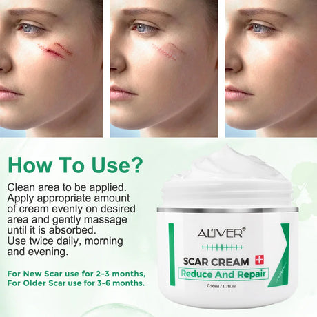 ALVER Acne Scar Stretch Marks Remover Cream Skin Repair Acne Black Dots Spots Acne Treatment Blackhead Bleaching Cream 50ml