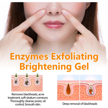Enzymes Exfoliating Brightening Gel Salicylic Acid Blackhead Dead Skin Remover Cleansing Shrink Pores Brightening Delicate Skin